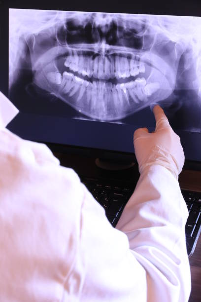 Best Emergency Wisdom Teeth Removal in Perry, OK